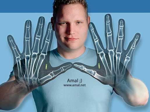 Amal Graafstra has RFID chips in his hands