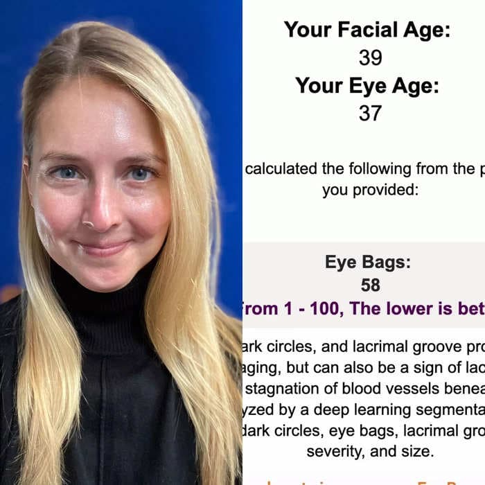 I’m 36, but an AI test told me my ‘face age’ is 39 with severe wrinkles — I respectfully disagree