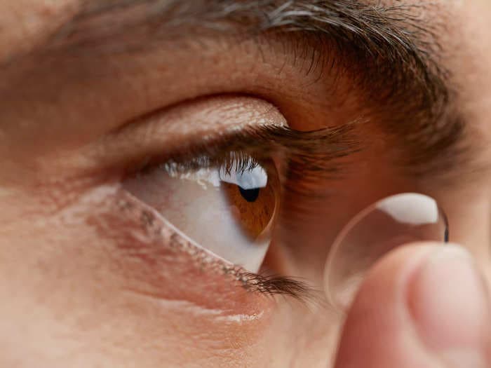 A man kept the same pair of contact lenses in for 3 years, causing permanent astigmatism and buildup behind his eyelids. His doctor said he's not responsible enough to wear contacts.