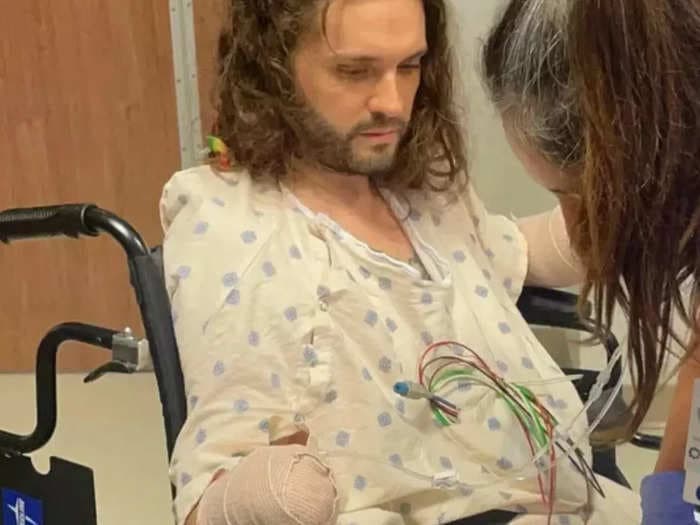 A Texas man lost both his hands and all of his toes after contracting typhus from a single flea bite