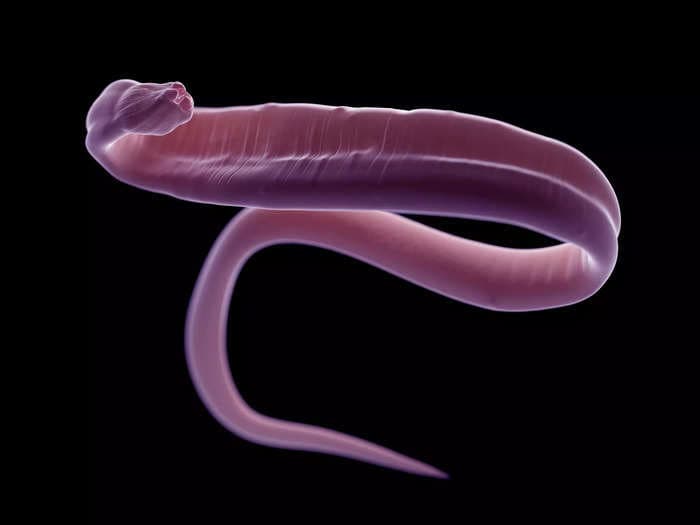 A woman had abdominal pain, depression and a cough. Doctors pulled a live worm from her brain.