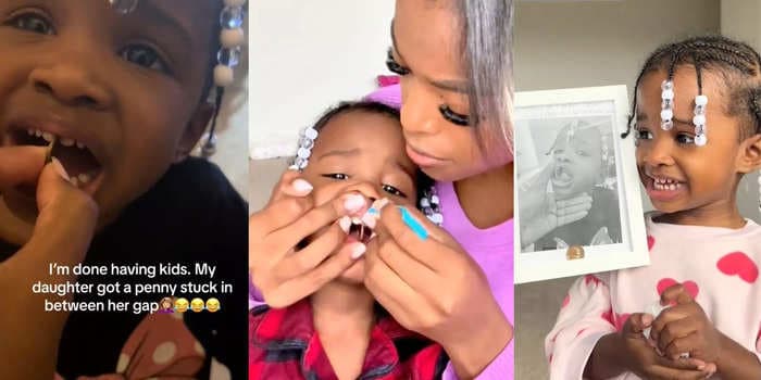 A mom filmed her toddler after she got a penny stuck between her front teeth. A day later, it happened again.