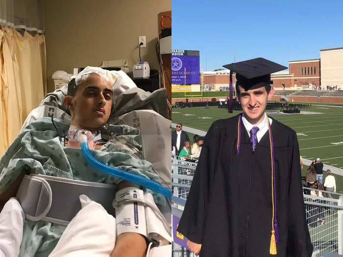 I was diagnosed with a near-fatal brain condition. I had surgery, recovered, and graduated college 5 years later.