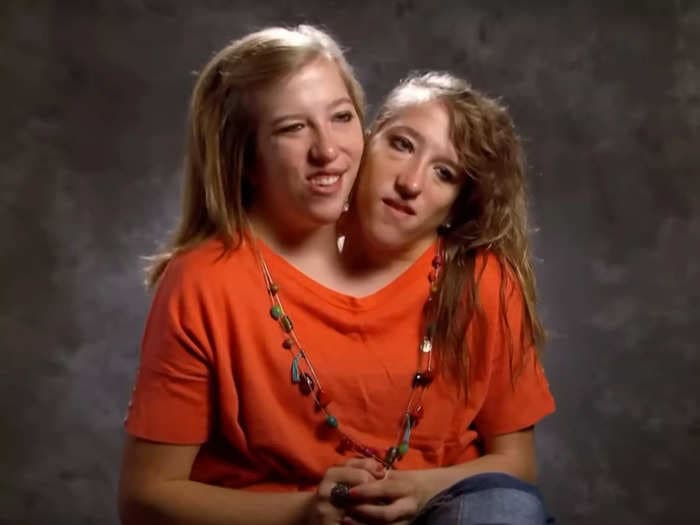 Where are conjoined twins and former reality TV stars Abby and Brittany Hensel now?