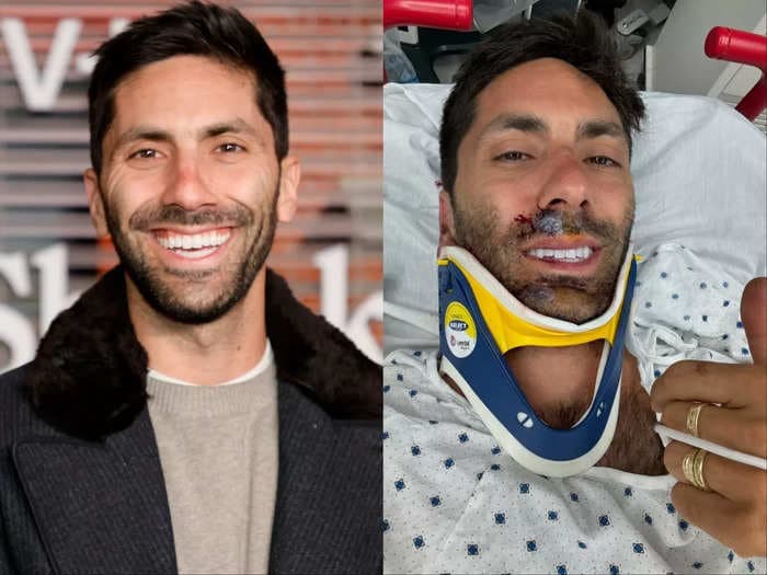 'Catfish' star Nev Schulman says he broke his neck in a collision with a truck: 'C5 and C6 to be exact'