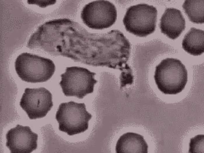 White Blood Cell Chases Down And Gobbles Up Bacteria [GIF]