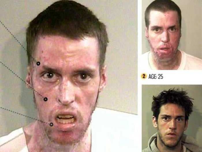 This App Shows What Your Face Looks Like After 5 Years Of Meth Abuse