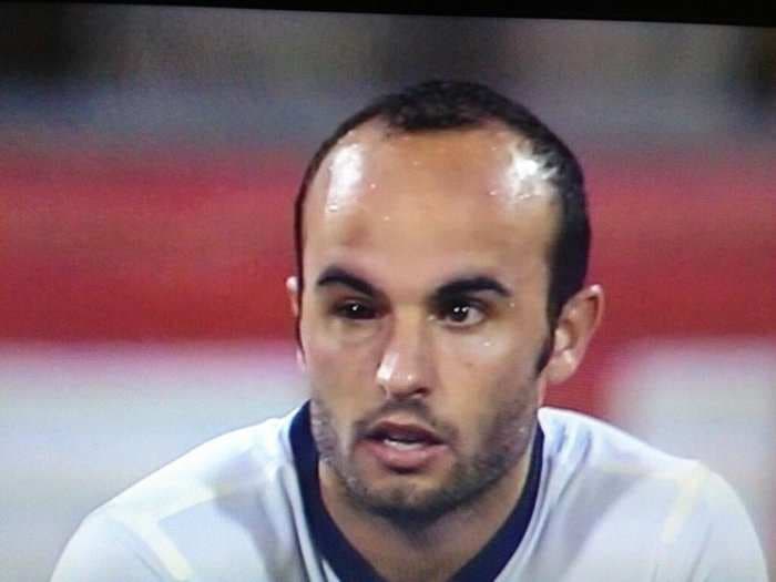 Landon Donovan Is Playing The USA-Mexico Game With Some Sort Of Nasty Eye Infection