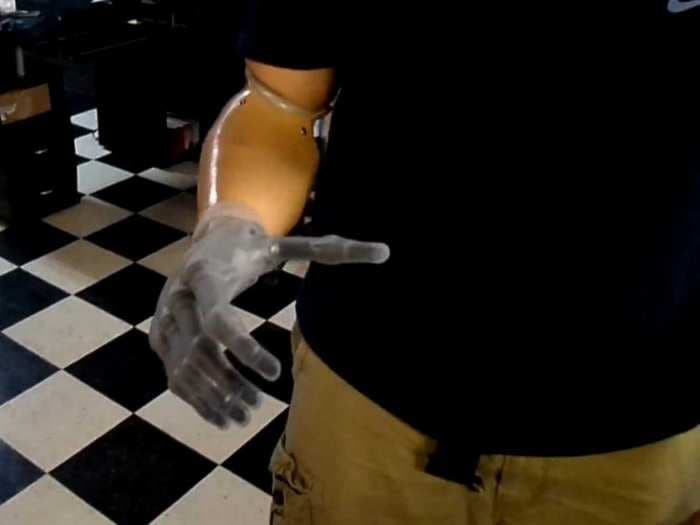 This Robotic 'Terminator' Hand Is The Realest Prosthetic We've Seen Yet