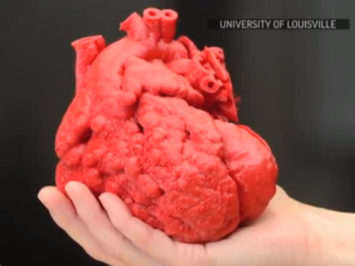 Researchers In Kentucky Are Trying To 3D Print A Working Human Heart Out Of Fat Cells