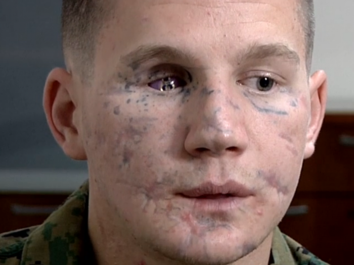 The Marine Corps' Latest Medal Of Honor Hero Says He's 'Just Getting Started'