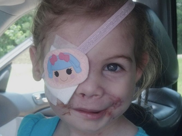 KFC Apologizes For Kicking A Little Girl Out Of Its Restaurant Because Of Her Facial Injuries