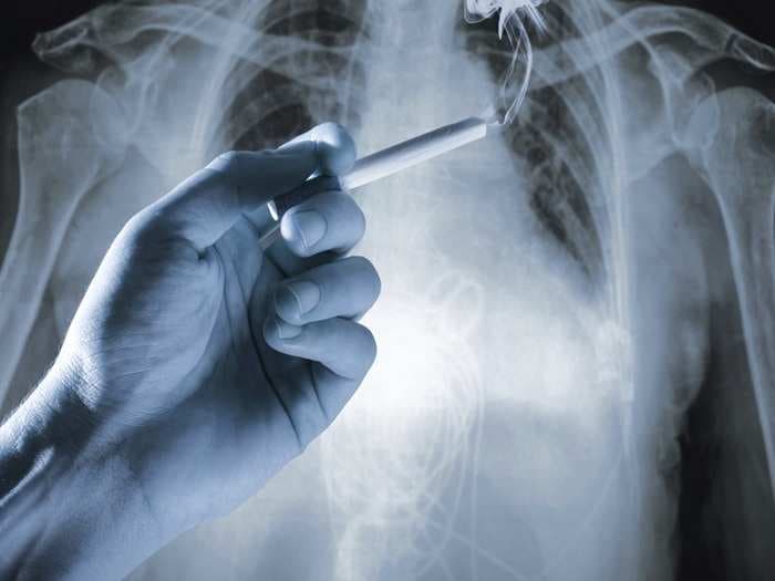 Nanotechnology-based Device Can Detect Lung Cancer: Study