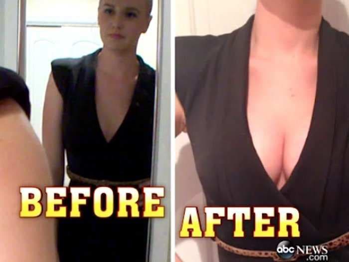 New 'Instant Makeover' Boob Job Claims To Last 24 Hours And Take 20 Minutes