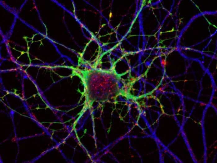 A 'new view' in science could bring treatments for mysterious brain disorders within reach