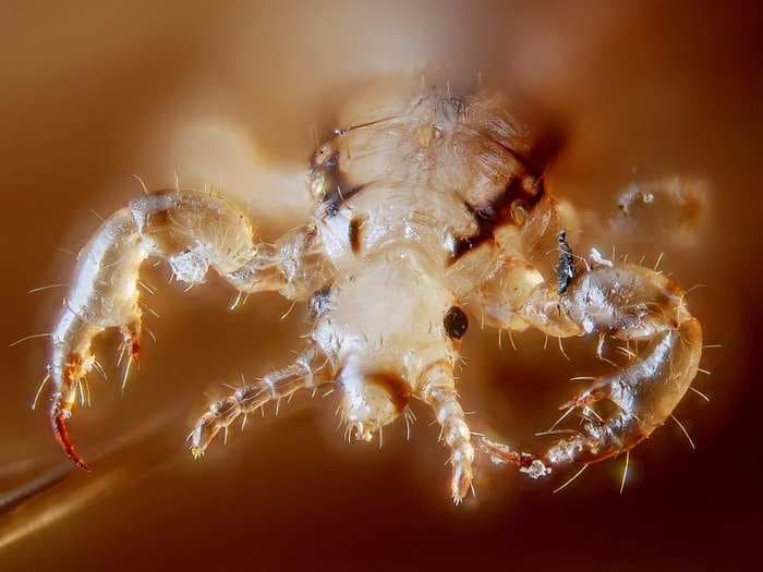 Mutant lice are infesting kids all over the US