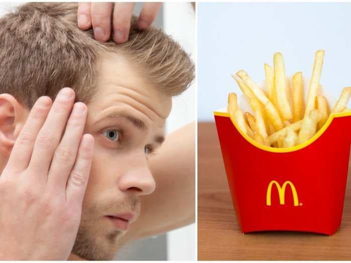 A chemical used to make McDonald's fries could help cure baldness, Japanese scientists say