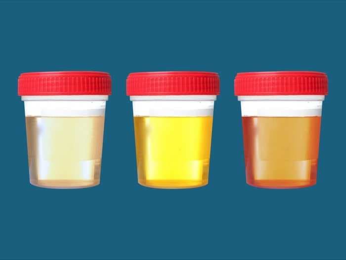 What the color of your urine says about your health and hydration