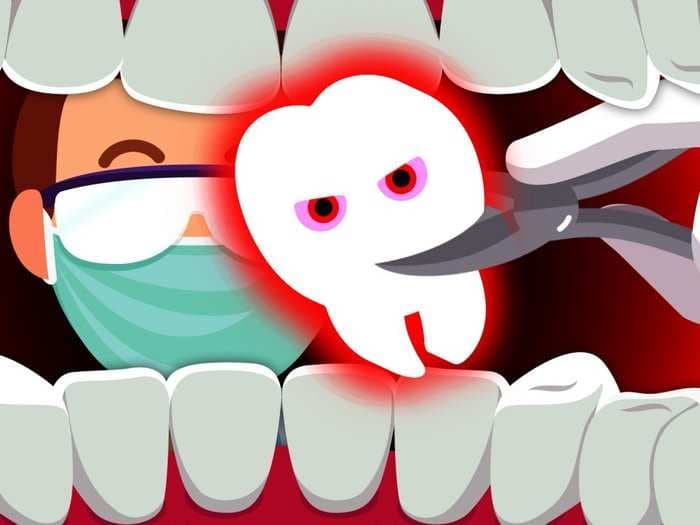 Why 5&#160;million Americans get their wisdom teeth removed each year