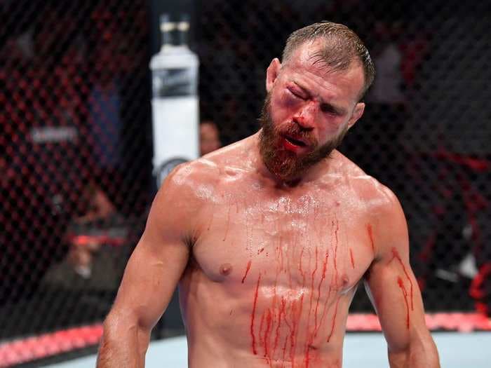 A UFC fighter's eye swelled shut so badly after he tried to blow his nose that they had to stop the fight