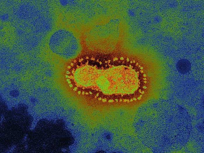 The coronavirus' crown-like spikes give the virus family its name - here's what it looks like