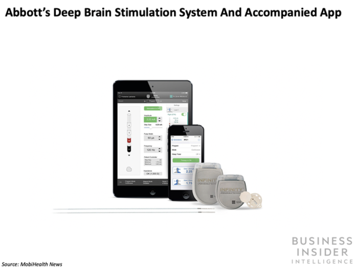 Abbott received expanded FDA clearance for its Deep Brain Stimulation system for Parkinson's