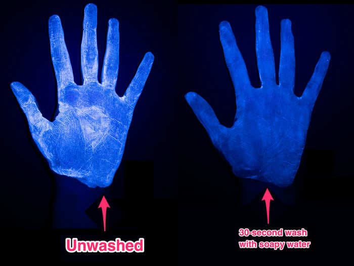 Photos show why hand sanitizer doesn't work as well as soap and water to remove germs