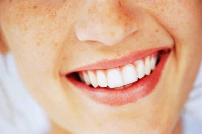 How to whiten your teeth naturally, with at-home methods