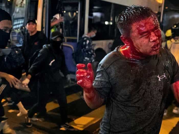 20 Pulitzer Prize-winning photographs capture the stunning violence from last year's Hong Kong protests