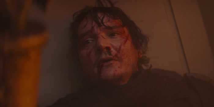 'The Mandalorian' star Pedro Pascal says he injured his face and had to get stitches right before filming his big unmasking scene in the finale of season 1