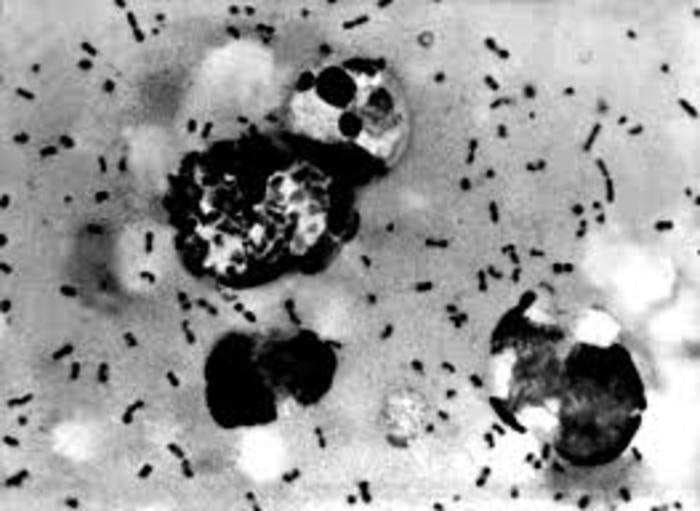 What is bubonic plague⁠— its symptoms, fatality rate and history