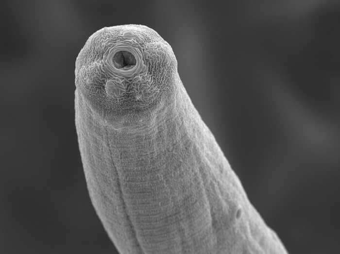 A scientist won $1.8 million to study how parasitic worms suppress our immune systems with venom to live inside us undetected