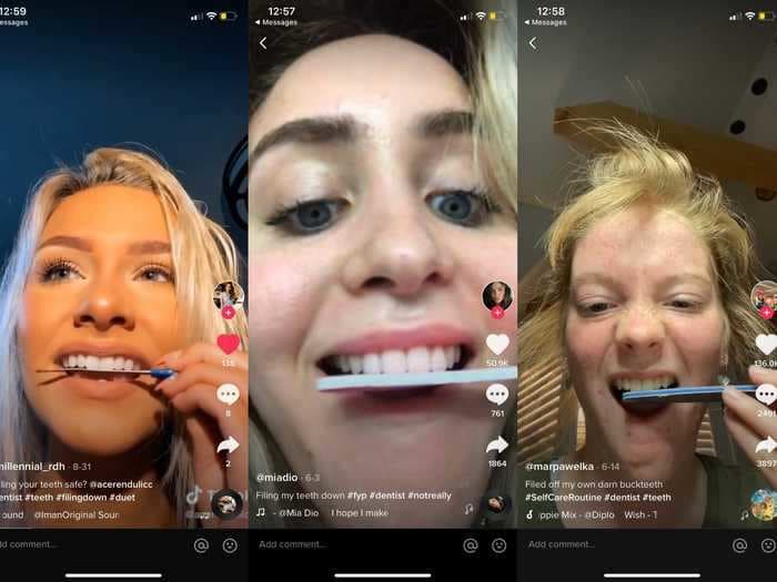 TikTok users are shaving down their teeth with nail files. Dentists say it could cause permanent damage.