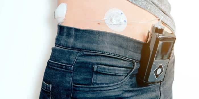 How to use an insulin pump to easily manage blood sugar levels