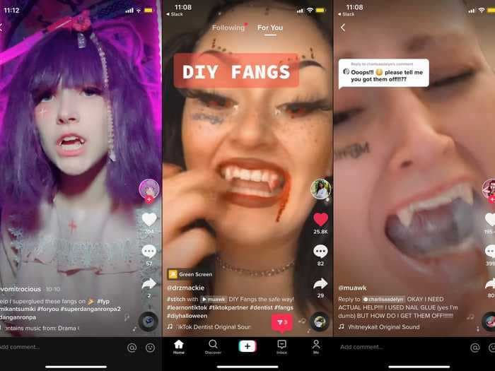 TikTok users are super-gluing vampire fangs to their teeth, and struggling to get them off. Dentists are not happy about it.