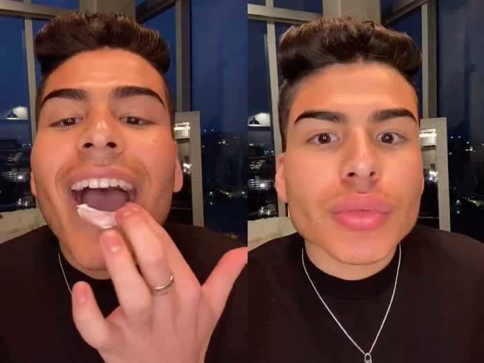 A TikTok user plumped up his lips with erection cream, but experts say it could leave you with cracked, painful skin