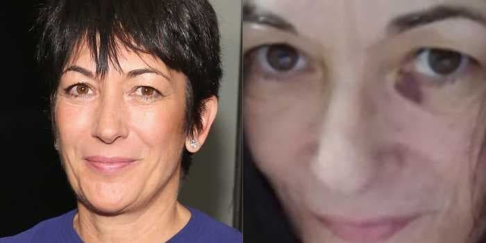 Ghislaine Maxwell appears with what looks like a black eye in her first photo from jail