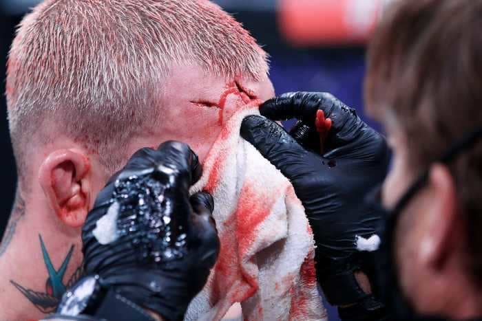 Photos from a Bellator MMA event show an American athlete so bloody it was like he'd been attacked with knives