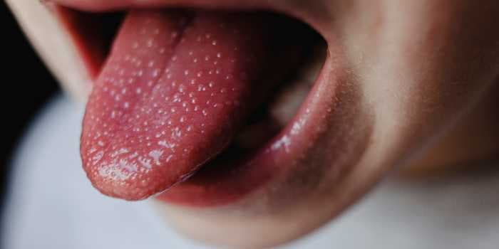 What those bumps on your tongue mean and how to get rid of them