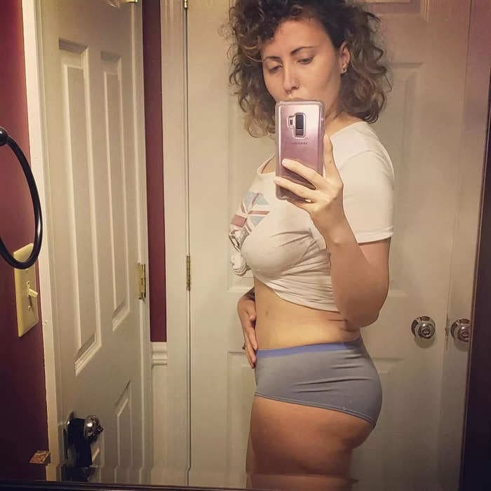 I'm a mom who had 2 Brazilian butt lifts. After spending $10,000, I have no regrets.