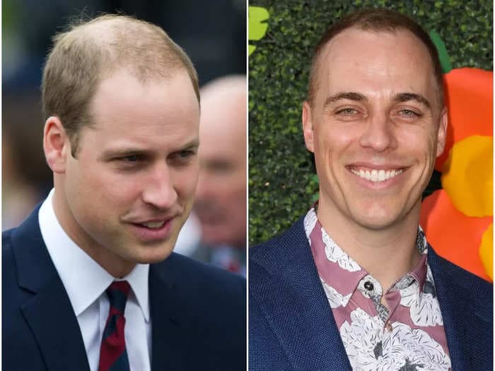 The actor who plays Prince William in the new Lifetime movie said he added a bald patch to his head and pursed his lips to get into character