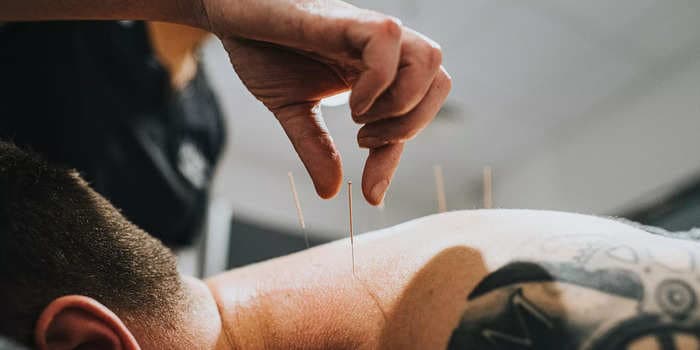8 research-backed benefits of acupuncture from pain relief to stress reduction