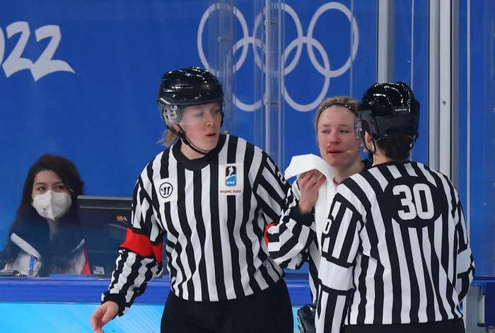 A Olympics hockey referee got her face slashed during the USA-Canada match and needed stitches but returned to finish the game