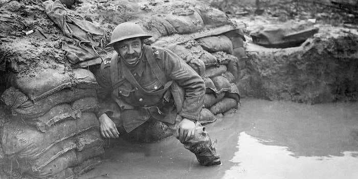 How to recognize and treat trench foot — the deadly condition that claimed thousands of lives in WWI