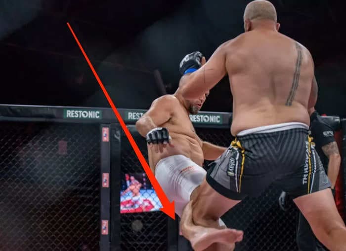 The nastiest leg break of the combat sports year so far took place at a recent MMA event