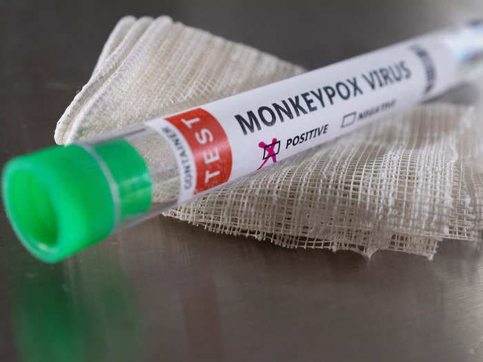 WHO advisor says monkeypox outbreak is likely a 'random event' spread through sex at 2 different raves in Europe