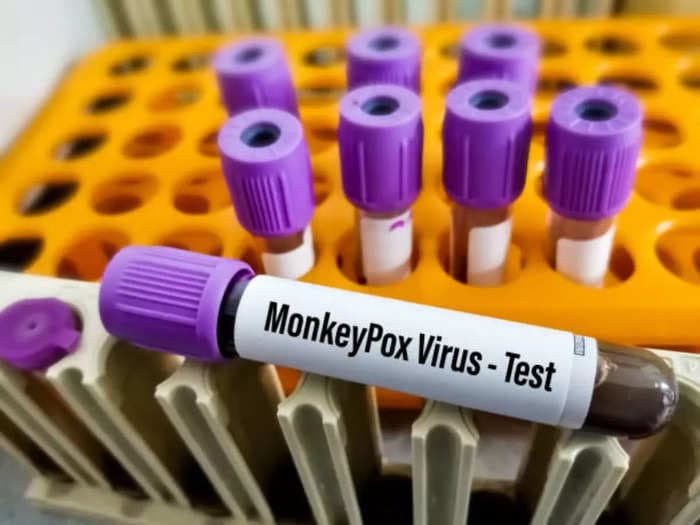 Monkeypox jab be given to at-risk gay, bisexual men, says UK report