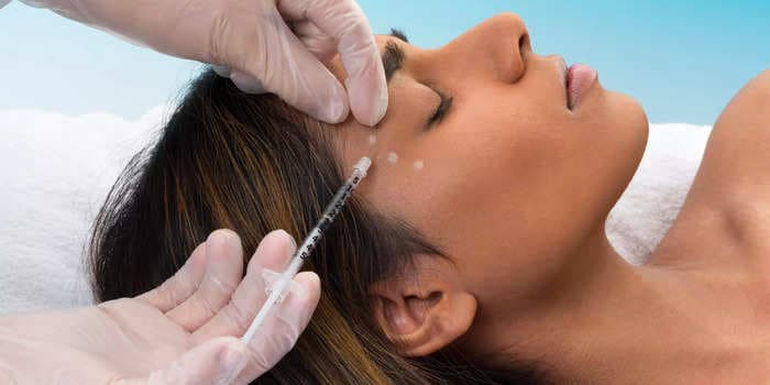 All the side effects of Botox — including rare reactions like drooping brows