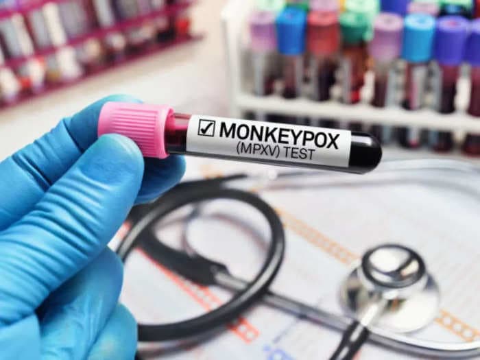 Monkeypox outbreak in India: Here’s what we know so far about symptoms, prevention of the infection