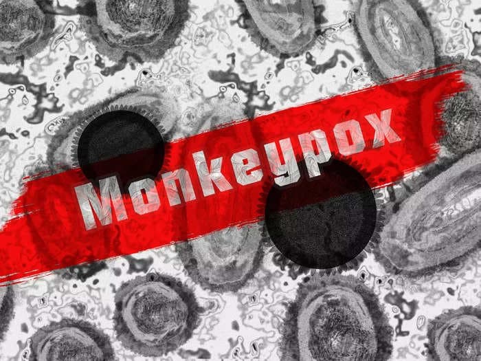 Suspected case of monkeypox in UP's Aurraiya district